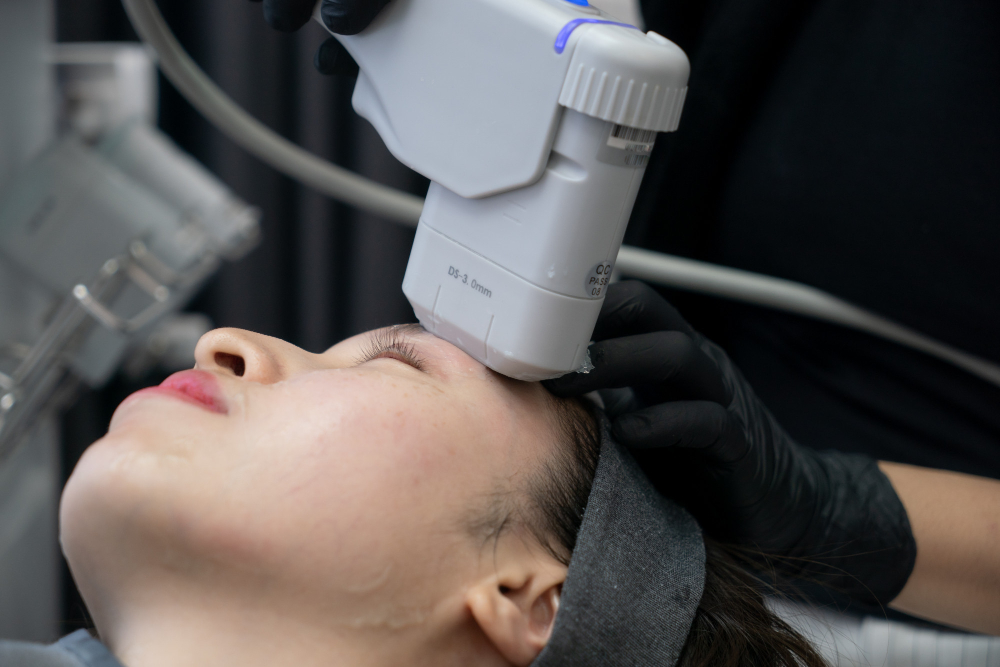 Liftera: o que é, como funciona e por que é o lifting sem cirurgia mais procurado